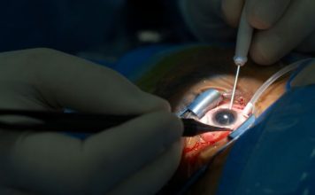 Cataract Surgery: What to Expect Before, During and Afterwards Cataract Surgery
