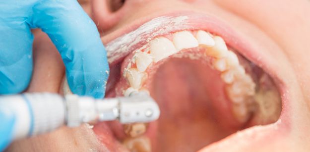 conscious sedation for tooth extraction