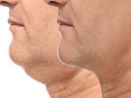 Anti-Aging Skincare Tips- How to Lose a Double Chin Fast