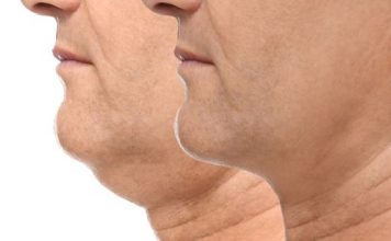 Anti-Aging Skincare Tips: How to Lose a Double Chin Fast Anti-Aging Skincare Tips- How to Lose a Double Chin Fast